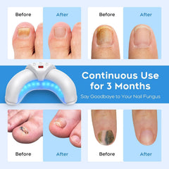 ZZP Nail Repair Solution for damaged nails improving appearance over time